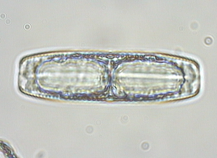 Dictyocha speculum